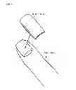 Fig. 06 - Artificial nail