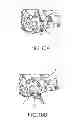 Fig. 09 - Band Tensioning Tool Insert