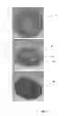 Fig. 08 - Lid for beverage container