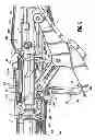 Fig. 06 - Surgical stapling device