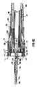 Fig. 48 - Surgical stapling device