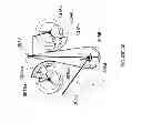 Fig. 31 - Apparatus and an assembly for emulating an impulse force exerted by a skeletal muscle