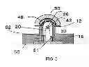 Fig. 04 - Plasma generator