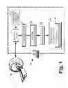 Fig. 02 - Black blood MRI using a stimulated echo pulse sequence with flow sensitization gradients