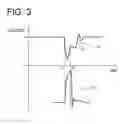 Fig. 03 - PULSE GENERATOR