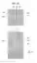Fig. 11 - Liquid crystal display