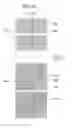 Fig. 17 - Liquid crystal display
