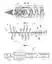 Fig. 02 - Coherence gated doppler motion sensor and medical applications