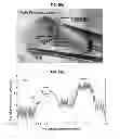 Fig. 12 - Coherence gated doppler motion sensor and medical applications