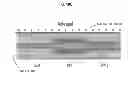 Fig. 13 - Coherence gated doppler motion sensor and medical applications