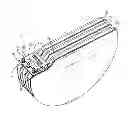 Fig. 01 - Implantable cardioverter defibrillator capacitor assembly with flex circuit
