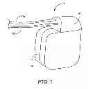 Fig. 02 - Implantable cardioverter defibrillator capacitor assembly with flex circuit