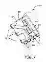 Fig. 08 - Implantable cardioverter defibrillator capacitor assembly with flex circuit