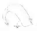 Fig. 01 - Apparatus, systems and methods for relieving tinnitus, hyperacusis and/or hearing loss