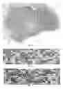Fig. 08 - System and method to determine slide quality of a digitized microscope slide