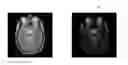 Fig. 01 - Interferometric techniques for magnetic resonance imaging