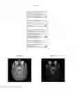 Fig. 02 - Interferometric techniques for magnetic resonance imaging