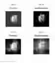 Fig. 08 - Interferometric techniques for magnetic resonance imaging