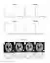 Fig. 09 - Interferometric techniques for magnetic resonance imaging