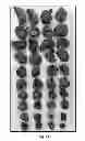 Fig. 16 - Labeled, non-peptidic, multivalent integrin antagonist compounds; methods for synthesis and uses thereof