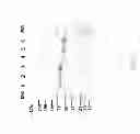 Fig. 02 - Methods for treating lysosomal acid lipase deficiency