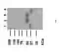 Fig. 03 - Methods for treating lysosomal acid lipase deficiency