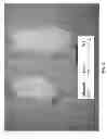 Fig. 04 - Methods for treating lysosomal acid lipase deficiency