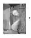 Fig. 05 - Methods for treating lysosomal acid lipase deficiency