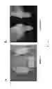 Fig. 07 - Methods for treating lysosomal acid lipase deficiency