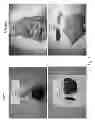 Fig. 08 - Methods for treating lysosomal acid lipase deficiency