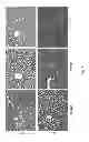 Fig. 10 - Methods for treating lysosomal acid lipase deficiency