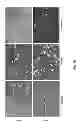 Fig. 11 - Methods for treating lysosomal acid lipase deficiency