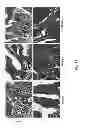 Fig. 12 - Methods for treating lysosomal acid lipase deficiency
