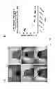 Fig. 21 - Methods for treating lysosomal acid lipase deficiency