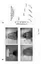 Fig. 23 - Methods for treating lysosomal acid lipase deficiency