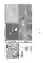 Fig. 26 - Methods for treating lysosomal acid lipase deficiency