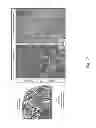 Fig. 27 - Methods for treating lysosomal acid lipase deficiency