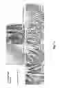 Fig. 34 - Methods for treating lysosomal acid lipase deficiency