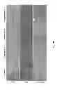 Fig. 50 - Methods for treating lysosomal acid lipase deficiency