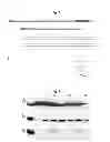 Fig. 02 - Method of peptide hydrolysis, peptidase, the composition for use as a bacteriostatic and bactericidal agent, a kit and the uses of the active form of LytM from or derivatives thereof