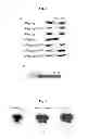 Fig. 03 - Method of peptide hydrolysis, peptidase, the composition for use as a bacteriostatic and bactericidal agent, a kit and the uses of the active form of LytM from or derivatives thereof