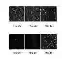 Fig. 03 - Antibody based reagent that specifically recognizes toxic oligomeric form of beta-amyloid