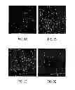 Fig. 04 - Antibody based reagent that specifically recognizes toxic oligomeric form of beta-amyloid