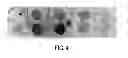 Fig. 05 - Antibody based reagent that specifically recognizes toxic oligomeric form of beta-amyloid