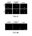Fig. 10 - Diagnostic and Therapeutic Targets for Leukemia