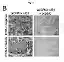 Fig. 16 - B-type plexin antagonists and uses thereof