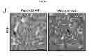 Fig. 37 - B-type plexin antagonists and uses thereof