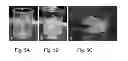 Fig. 06 - Method of forming a fiber made of peptide nanostructures