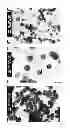 Fig. 05 - Zinc oxide particles, method for production of the same, and cosmetic, heat releasing filler, heat releasing resin composition, heat releasing grease, and heat releasing coating composition comprising the same