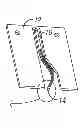 Fig. 01 - PROBE FABRICATION USING COMBINED LASER AND MICRO-FABRICATION TECHNOLOGIES